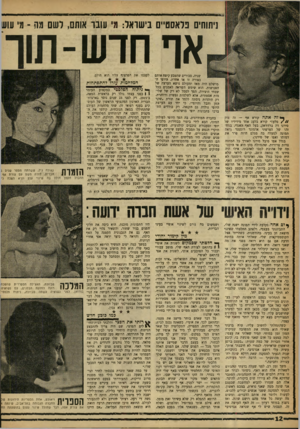 העולם הזה - גליון 1217 - 18 בינואר 1961 - עמוד 12 | ניתוחים נלאסט״ם בישראל: מ׳ עובו אותם, רשם מה -מי עוש אף חדש-תור שניה, סבורים שהטבע קיפח אותם בצורה זו או אחרת. היופי המושלם חיה מאז ומעולם נושא הערצה של