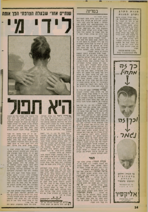 העולם הזה - גליון 1261 - 8 בנובמבר 1961 - עמוד 12 | הקרב מנות המנות וקרב ״מנת הברזל״ הקרבית נקראת בלועזית בשם א 0 :ד ^ 1מ. מ ; שם זה ניתן לה לכבודו של ד״ר קיס, הפיזיולוג האמריקאי הנודע, שקבע במחקריו כיצד לשמור