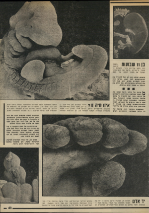 העולם הזה - גליון 1997 - 10 בדצמבר 1975 - עמוד 43 | בן 11 שבועות ניכר היטב אבר־מין זיכרי. התצלום, המוגדל פי־שניים, מראה את חוט־הטבור המחבר את הסובר לגופה של האס. מראות. אולם הוא לא יכול להחדיר את המיקרוסקופ לגוף