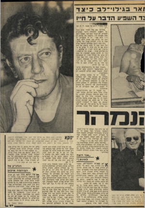 העולם הזה - גליון 2044 - 3 בנובמבר 1976 - עמוד 27 | אר בגידוי ־ לבכיצד 3ד השפיע הדברעד חייו 1וווו 11 וווי!ז1ת 6<—18ב8י—<*יוו — ואתה מתחיל לרחם על עצמך. לי זה הפ ריע. ״אחר־כך באו אלי להדר איזה שיב־עה רופאים