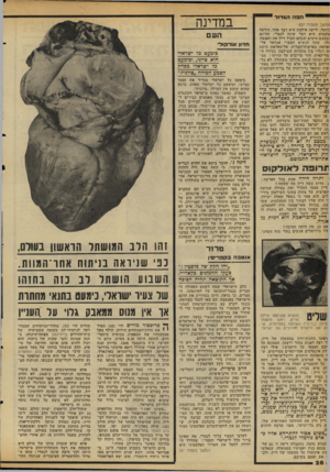 העולם הזה - גליון 2112 - 22 בפברואר 1978 - עמוד 28 | הפה הגדול המשך מעמוד )27 :יותר. ידיעה אילמת היא דבר אחד, הודעה !ומבית היא דבר שונה לגמרי. מודגם זבעצם הימים שבהם הטיל דיין את הפצצה זלו, שהה הנשיא המצרי אנוואר