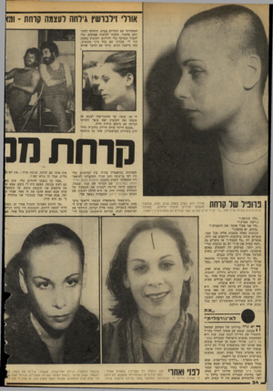 העולם הזה - גליון 2140 - 6 בספטמבר 1978 - עמוד 35 | אורלי זילבושץ גילחה לעצמה קדחת ־ 00 הסתדרתי עם ההורים בבית, ורציתי להתרחק מהעיר. הלכתי לקיבוץ אפיקים, כדי לעבוד ובעיקר כדי להירגע. הקיבוץ באמת עזר לי. עבדתי שם