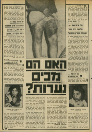העולם הזה - גליון 2206 - 12 בדצמבר 1979 - עמוד 37 | ^ צין כמרים חקר אותי, ובחורה ן הרביצה לי במקל,״ טענה נערה בת 14 ממחנה הפליטים ג׳ילזון .״הקצין רצה לדעת אם השתתפתי בהפגנה ואם שרפתי צמיגים. הבחורה הרביצה לי כל