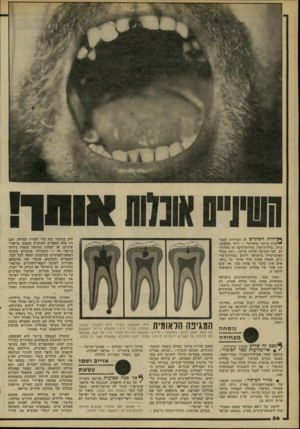 העולם הזה - גליון 2264 - 21 בינואר 1981 - עמוד 57 | } י חלות השיניים הן המחלות הנפו- ״ יצות ביותר בישראל — יותר משפעת, נזלת, מחלות־עור, מחלות־קיבה או מחלות־לב. לפי הערכה זהירה ביותר, ס 940/מכלל האוכלוסייה בישראל