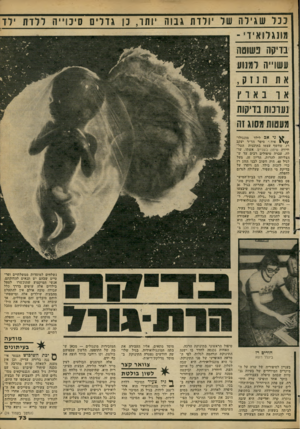 העולם הזה - גליון 2278 - 29 באפריל 1981 - עמוד 73 | ככל שגי ל ה של יולד ת ג בו ה יו תז, נן ן אדליז) 1זינווי יהללדת מונג לו אי ד׳ ־ בויקה נשוסה עשו״ה למנוע את הנזק , גי אב לילד מונגולו־ איד,״ סיפר הד״ר יעקב רז,