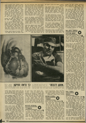 העולם הזה - גליון 2320 - 17 בפברואר 1982 - עמוד 74 | רורגיית־לב פרטית.״ הוא היה משוכנע שאין נשקפת סכנה לחיי־החולה שהוא יעד לניתוח הראשון, אך הפריעה לו רד עובדיה, שהסוד נודע. אילו הצליח לבצע את הניתוח מבלי שייוודע