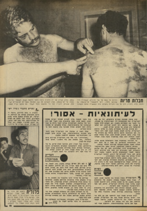 העולם הזה - גליון 2342 - 21 ביולי 1982 - עמוד 11 | חבלות טריות ניכרות על גופם של שני הדרוזים, ששוחררו מידי שוביהם. מימין: ריאד איסמאעיל אל״קונטאר, על נויצחו כוויה. לדבריו, כיבו מל פניו סיגריות בוערות. עינו