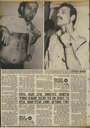 העולם הזה - גליון 2388 - 8 ביוני 1983 - עמוד 69 | שני הסוהרים שנלקחו בבני־ערובה, דויד ספיה ומשה 1גרטי, מציגים לפני העיתונאים והצלמים את הדקירות בגופם. שילשונות הכלא דאגו לדווח לעיתונאים על תשע דקירות בגופו של