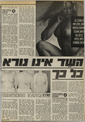 העולם הזה - גליון 2404 - 27 בספטמבר 1983 - עמוד 24 | את הפיטמה בונים, בדרר״בלל, מחלק הפיטמה של השד השני, שמעבירים אותו כשתל לשד המשוחזר. את העטרה הסובבת את הפיטמה מקבלים משתל־עור ממקום מתאים, שזה יכול להיות החלק
