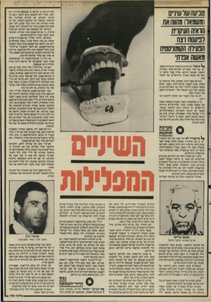 העולם הזה - גליון 2499 - 24 ביולי 1985 - עמוד 33 | טביעהשלשיניים (משמאל) מהווהאת הראיה העיקרית לביענוח רצח הנעילה הקומוניסטית מאשה אניח׳ ך א בכל יום מזמינים השוטרים בבית״המעצר < את אחד העצירים לארוחת־בוקר