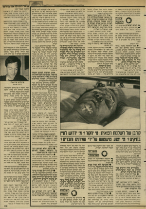 העולם הזה - גליון 2577 - 21 בינואר 1987 - עמוד 29 | ־ 1<..ל ד 01ר 16א ח ^ ר -פירסומת לעיתים קרובות רופאים — פעם מבית־החולים רוטשילד בחיפה ופעם מבית־החולים קפלן ברחובות ופעם מבית־החולים איכילוב בתל־אביב. ^ עיוות