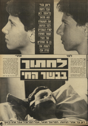העולם הזה - גליון 2665 - 28 בספטמבר 1988 - עמוד 35 | ^ ת הלילה האחרון לפני הניתוח ביליתי במערכת העולם הזה. מני סיון ידעתי, שעבודה קשה ומאומצת משכיחה דאגות ופורקת לחצים. רציתי לשכוח את הניתוח ולא להיזכר בו, ממש עד
