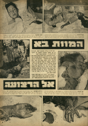 העולם הזה - גליון 934 - 8 בספטמבר 1955 - עמוד 3 | הכת הפצועה: הטרגדיה המשפחתית המזעזעת ביותר של השבוע: ההתקפה על המשפחה ליד מעברת קובייבה. האב נהרג, האם, הבת .,הבן והחתן׳נפצעו. בתמונה: חבת, גוריה יאיר,